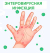 Энтеровирусная инфекция и меры ее профилактики